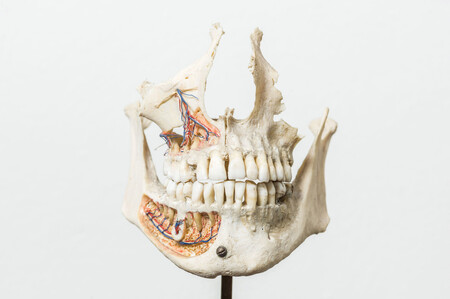 gustav-korkhaus-sammlung_universitaetsklinikum bonn_gebiss-001