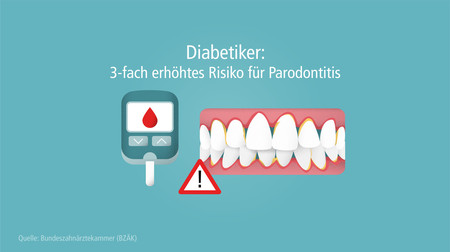 diabetes-parodontitis-001